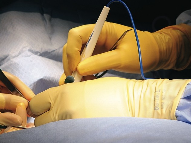 Gawande’s hands are at right in this photograph from the operating room.