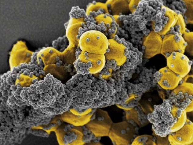A cluster of connected yellow spheres is covered in masses of much smaller gray spheres that resemble fish eggs.