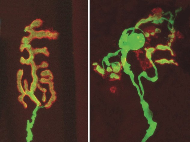 Image courtesy of Valdez, Tapia, Kang, et al. Exercise and caloric restriction both mitigate the degradation of synapses that occurs with age. In the healthy synapse at left, the receiving end, or muscle receptor (red), and the transmitting end (yellow), attached to a nerve, overlay each other perfectly. With age, the synapse literally falls apart, as shown at right.