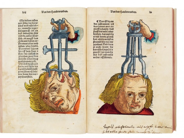 Image courtesy of the PhiladelPhia Museum of Art <i>Instruments for Use in Cranial Surgery,</i> from Hans von Gersdorff’s <i>Feldtbüch der Wundartzney</i> (1517), is both a <i>description</i> of how to remove shards of skull from the brain and a <i>tool</i> to persuade readers that such surgeries were possible.