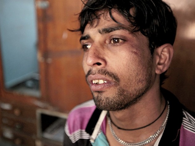 Photograph by Peter Pereira Ishwar ministers to other runaway youths at a drop-in center in Jaipur, as his own future hangs in the balance.
