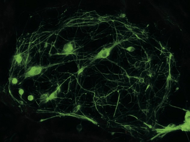 Motor neurons produced from reprogrammed cells enable researchers to study ALS in a petri dish.