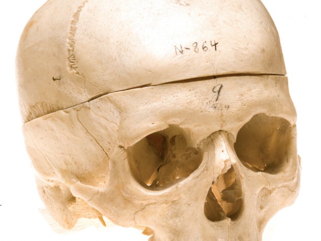 Human <i>(H. sapiens)</i>