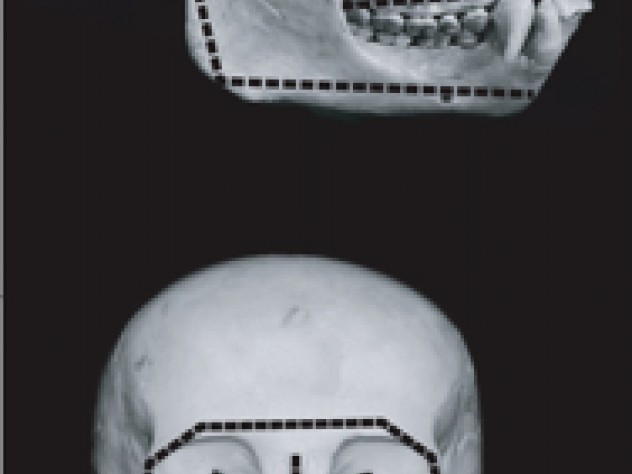 Front and side views of adult chimpanzee and human skulls highlight differences in patterns of facial growth. In both species, faces grow wider and taller, but chimp faces grow out and up to become more projecting, while the smaller human face remains tucked under the cranium.