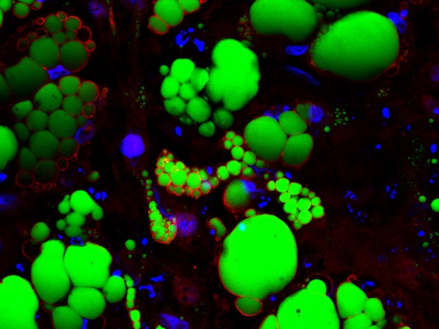These fat cells were created from human pluripotent stem cells. Being able to create vast numbers of such cells allows scientists to test millions of drug compounds in a petri dish.