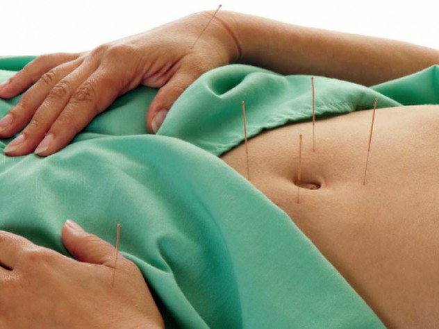 A patient undergoes acupuncture of the belly