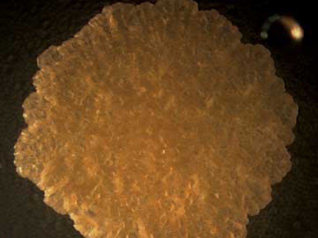 Mycobacteria form greasy, fatty-looking colonies. Their thick lipid coatings may play a role in allowing them to survive an onslught of antibiotics.