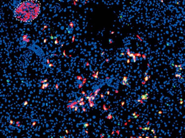 Viral delivery of a three-transcription-factor cocktail has transformed pancreatic exocrine cells (blue) into scattered insulin-producing beta cells (red). A preexisting islet, or grouping of beta cells, is outlined at the upper left.