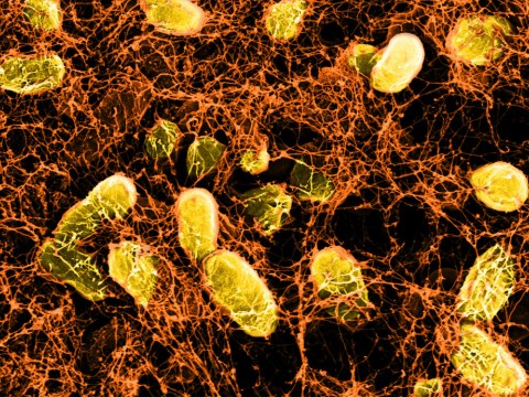 A network of curli fibers (produced by genetically altered E. coli bacteria) can bind to intestinal surfaces, where it acts like a Band-Aid, and can even deliver probiotic therapies.