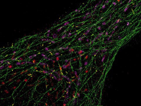 Super-resolution microscopy developed in the lab of Peng Yin allows researchers using conventional microscopes to see the inner workings of cells at the single molecule level. Above, microtubules (green) and mitochondria (purple) dominate the intracellular landscape.