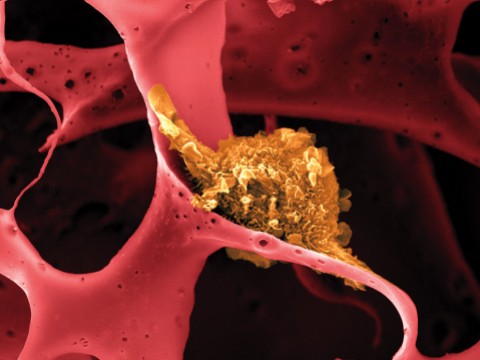 Image shows a dendritic cell (shown in yellow) attached to a man-made polymer lattice inside a pill-sized implantable device.