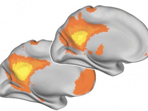 The younger brain, below, shows more synchronized activity than the older brain, above. 