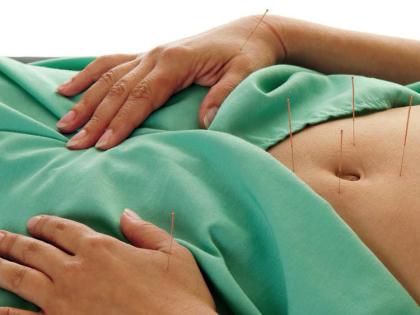 A patient undergoes acupuncture of the belly