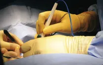 Gawande’s hands are at right in this photograph from the operating room.
