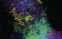 An induced pluripotent stem-cell colony produced in part by using a drug—a new, safer technique.