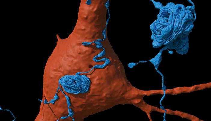 water dispenser essay Against the background of a single neuron (orange), an axon (blue) emanating from another cell whorls itself into tangled balls.