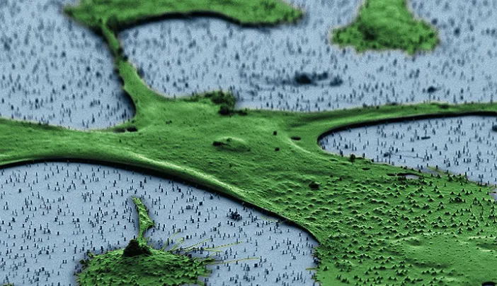 A human fibroblast—part of the body’s connective tissue—sits on a bed of vertical nanowires in this image from a scanning electron microscope. Hongkun Park and his colleagues hope that the nanowires, which penetrate the cell without harming it, can be a way to introduce genes into cells without the use of an engineered virus or invasive delivery method. One application could be adding a set of genes to fibroblasts that “reprogram” them to act like stem cells.