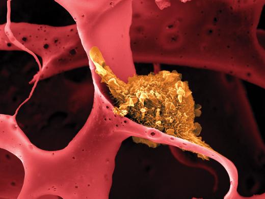 Image shows a dendritic cell (shown in yellow) attached to a man-made polymer lattice inside a pill-sized implantable device.