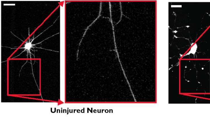 A comparison of healthy and injured neurons, from research by the Parker team. Injured neurons show localized swellings, as indicated by red arrows in the magnified image at far right.