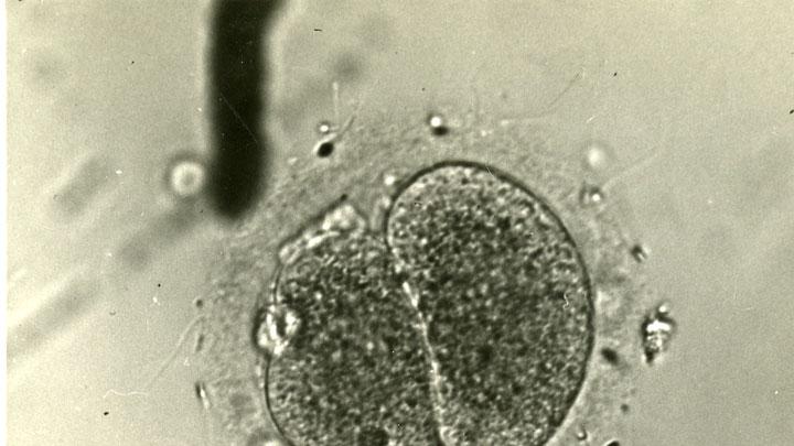 Rock, Hertig, and laboratory assistant Miriam Menkin conducted the first successful in vitro fertilization in 1944; this image shows the fertilized ovum from that experiment. (Research on in vitro fertilization was banned for a time in the United States; the first in vitro baby, Louise Brown, was born in England in 1978.)