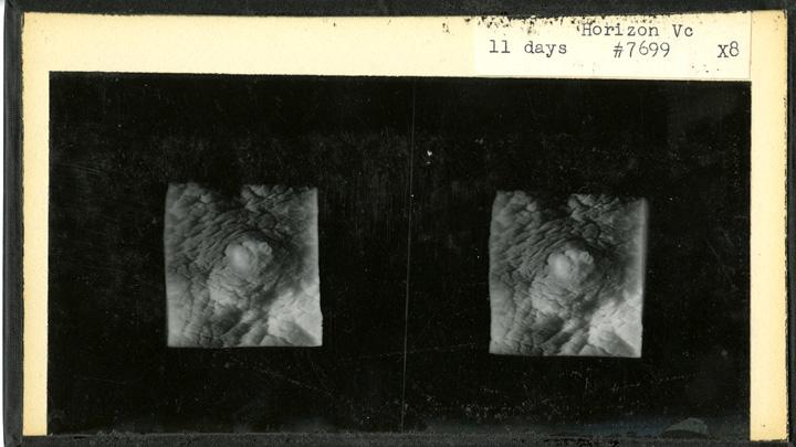 Rock and his Harvard Medical School colleague Arthur Hertig filled in gaps in knowledge about human reproduction by documenting the first 17 days after fertilization, using 34 fertilized ova removed from patients who were undergoing hysterectomies and consented to inclusion in this research. This stereopticon card from 1938 shows an embryo 11 days after fertilization.