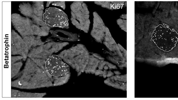 "White sparkles," as Melton calls them, indicate beta cell proliferation in this cross section of a pancreas from a betatrophin-treated mouse.