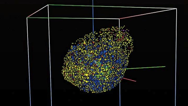 But to aid in the study and treatment of the disease, scientists and clinicians are turning increasingly to tools such as this three-dimensional brain-tumor simulation that shows the evolution of a population of cancer cells. (The colors indicate different clones of cancer cells.)