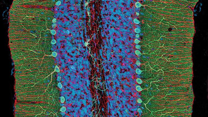 A photomicrograph showing different components of the rat cerebellum, including Purkinje neurons in green, glia (nonneuronal cells) in red, and cell nuclei in blue.