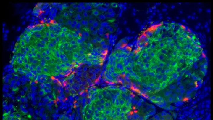 The image shows human-stem-cell-derived beta cells that have formed islet-like clusters in a mouse. The cells were transplanted to the kidney capsule (the fibrous connective layer surrounding the kidneys); the photograph was taken two weeks later, by which time the beta cells were making insulin and had cured the diabetes in the mouse.