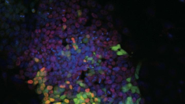 An induced pluripotent stem-cell colony produced in part by using a drug—a new, safer technique.