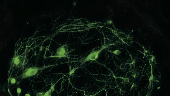 Motor neurons produced from reprogrammed cells enable researchers to study ALS in a petri dish.