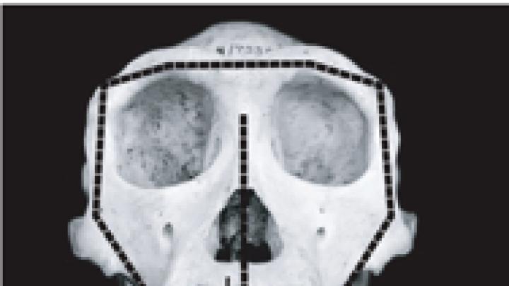 Front and side views of adult chimpanzee and human skulls highlight differences in patterns of facial growth. In both species, faces grow wider and taller, but chimp faces grow out and up to become more projecting, while the smaller human face remains tucked under the cranium.