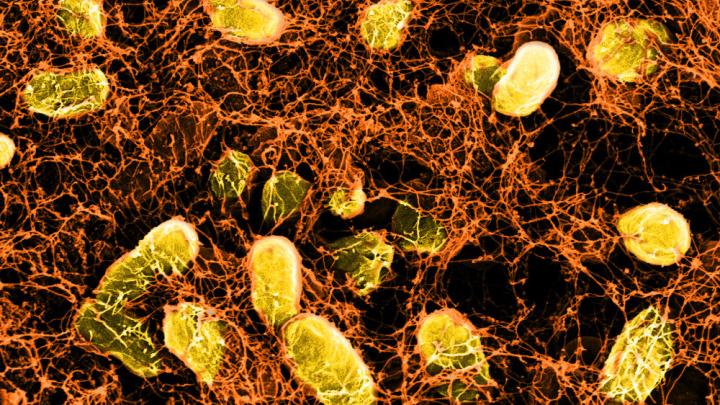 A network of curli fibers (produced by genetically altered E. coli bacteria) can bind to intestinal surfaces, where it acts like a Band-Aid, and can even deliver probiotic therapies.