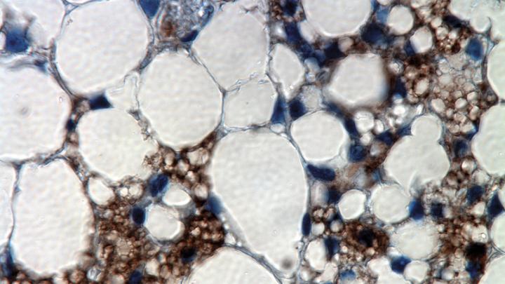 This image shows small brown-fat cells&mdash;which burn energy as heat&mdash;interspersed among larger white-fat cells, which store energy. The former are stained brown here; their natural color, which results from the density of mitochondria, would not be visible in this thin cross-section of tissue. (The blue staining marks cell nuclei.)