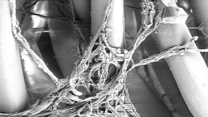 Mold, seen here at 1,000-times magnification, wraps itself around fibers. Depending on conditions, it can lie dormant or quickly overrun its host.