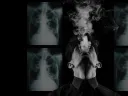 a person smoking in the foreground with x-rays of tuberculosis in the background