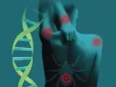 Abstract illustration of DNA, a patient's back with multiple bullseye rashes, and a deer tick.