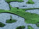 A human fibroblast—part of the body’s connective tissue—sits on a bed of vertical nanowires in this image from a scanning electron microscope. Hongkun Park and his colleagues hope that the nanowires, which penetrate the cell without harming it, can be a way to introduce genes into cells without the use of an engineered virus or invasive delivery method. One application could be adding a set of genes to fibroblasts that “reprogram” them to act like stem cells.