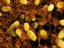 A network of curli fibers (produced by genetically altered E. coli bacteria) can bind to intestinal surfaces, where it acts like a Band-Aid, and can even deliver probiotic therapies.